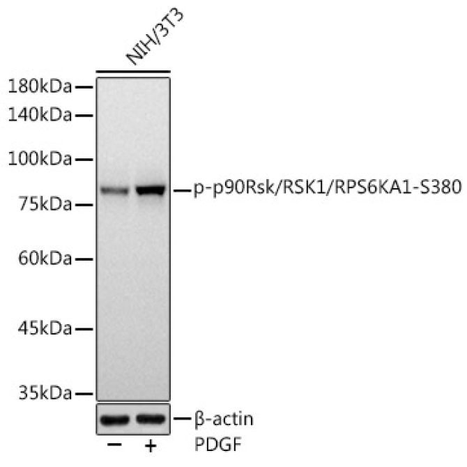 Phospho-p90Rsk/RSK1/RPS6KA1-S380 Rabbit Monoclonal Antibody