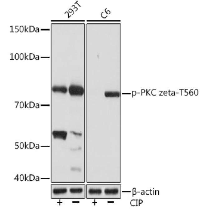 Phospho-PKC zeta-T560 Rabbit Monoclonal Antibody