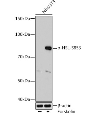 Phospho-HSL-S853 Rabbit Monoclonal Antibody