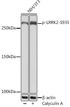 Phospho-LRRK2-S935 Rabbit Monoclonal Antibody