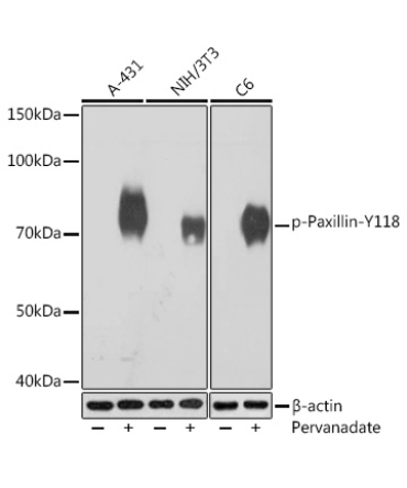 Phospho-Paxillin-Y118 Rabbit Monoclonal Antibody