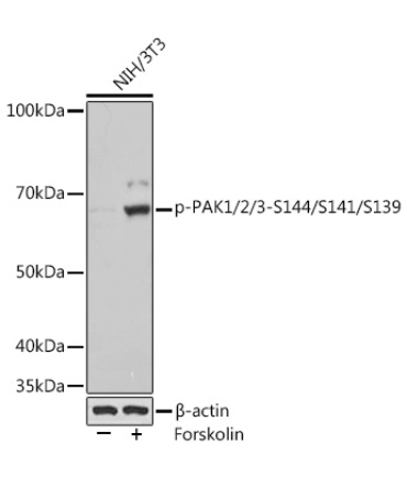 Phospho-PAK1/2/3-S144/S141/S139 Rabbit Monoclonal Antibody