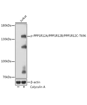 Phospho-PPP1R12A/PPP1R12B/PPP1R12C-T696 Rabbit Polyclonal Antibody