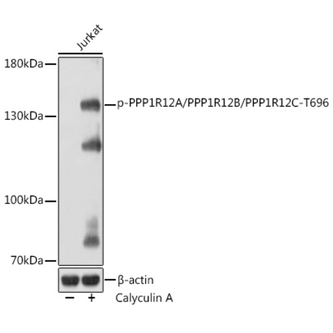 Phospho-PPP1R12A/PPP1R12B/PPP1R12C-T696 Rabbit Polyclonal Antibody