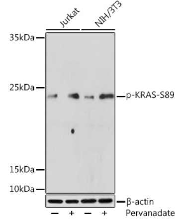 Phospho-KRAS-S89 Rabbit Polyclonal Antibody