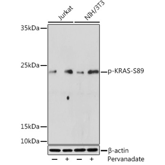 Phospho-KRAS-S89 Rabbit Polyclonal Antibody