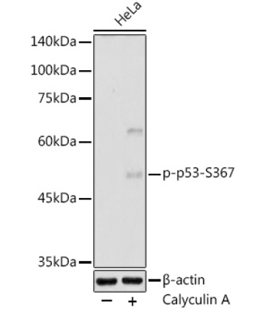 Phospho-p53-S367 Rabbit Polyclonal Antibody