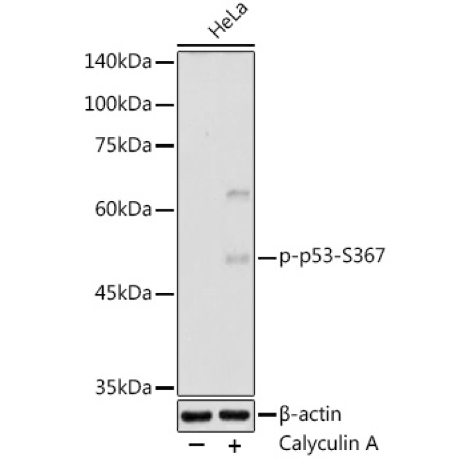 Phospho-p53-S367 Rabbit Polyclonal Antibody