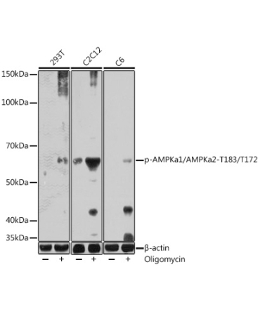 Phospho-AMPKa1/AMPKa2-T183/T172 Rabbit Polyclonal Antibody