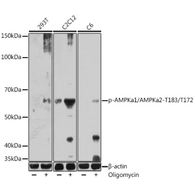 Phospho-AMPKa1/AMPKa2-T183/T172 Rabbit Polyclonal Antibody