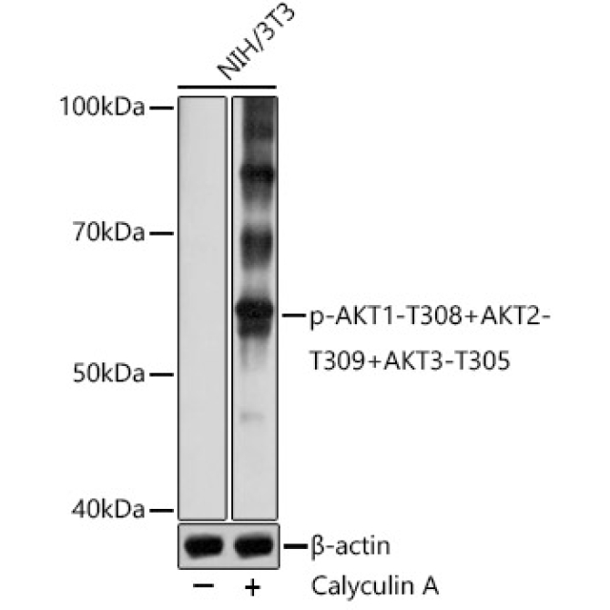 Phospho-AKT1-T308+AKT2-T309+AKT3-T305 Rabbit Polyclonal Antibody