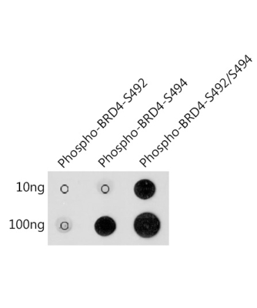 Phospho-BRD4-S492/S494 Rabbit Polyclonal Antibody