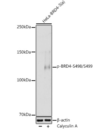 Phospho-BRD4-S498/S499 Rabbit Polyclonal Antibody