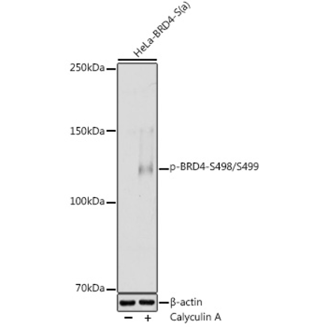 Phospho-BRD4-S498/S499 Rabbit Polyclonal Antibody