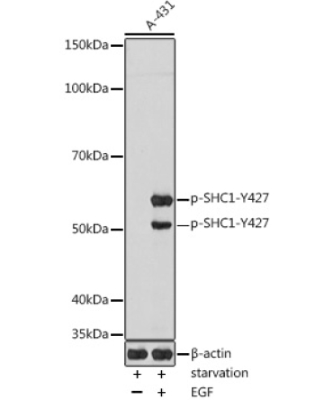 Phospho-SHC1-Y427 Rabbit Polyclonal Antibody