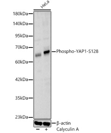 Phospho-YAP1-S128 Rabbit Polyclonal Antibody