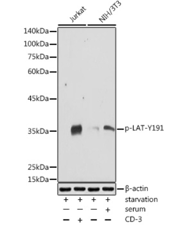 Phospho-LAT-Y191 Rabbit Polyclonal Antibody