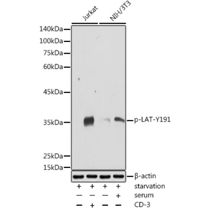 Phospho-LAT-Y191 Rabbit Polyclonal Antibody