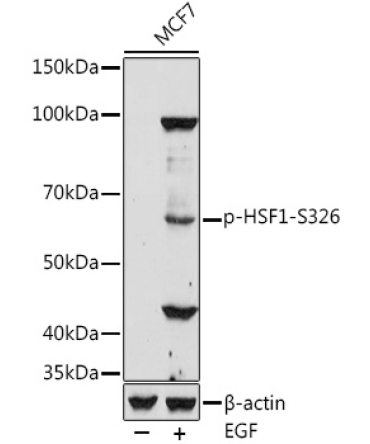 Phospho-HSF1-S326 Rabbit Polyclonal Antibody
