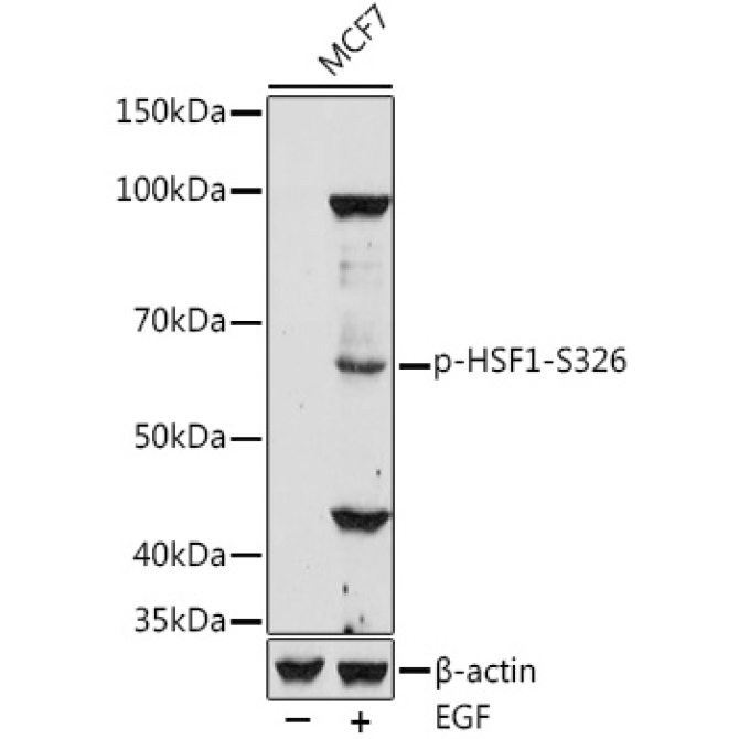 Phospho-HSF1-S326 Rabbit Polyclonal Antibody