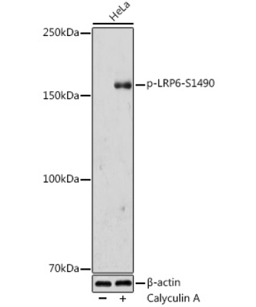 Phospho-LRP6-S1490 Rabbit Polyclonal Antibody