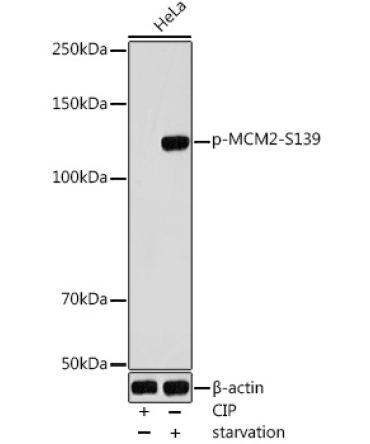 Phospho-MCM2-S139 Rabbit Polyclonal Antibody