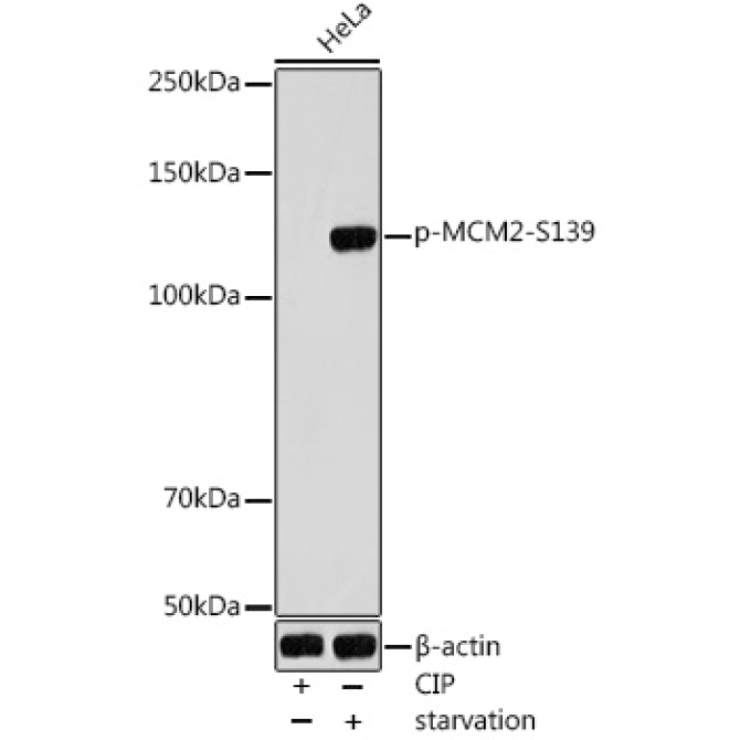 Phospho-MCM2-S139 Rabbit Polyclonal Antibody