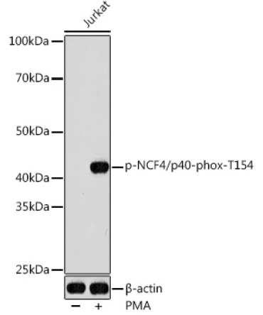 Phospho-NCF4/p40-phox-T154 Rabbit Polyclonal Antibody