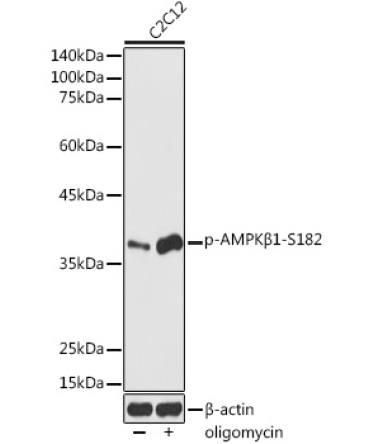 Phospho-AMPKBeta1-S182 Rabbit Polyclonal Antibody