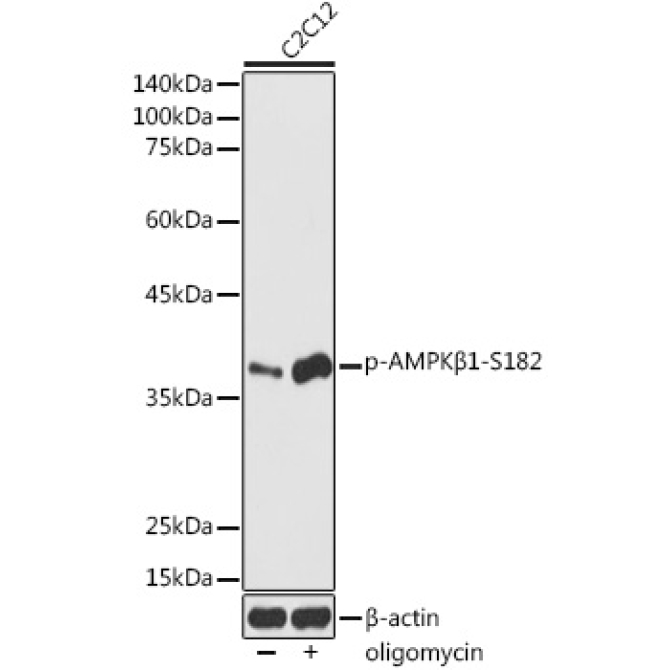 Phospho-AMPKBeta1-S182 Rabbit Polyclonal Antibody