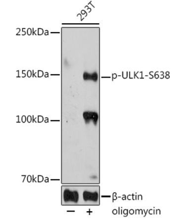 Phospho-ULK1-S638 Rabbit Polyclonal Antibody