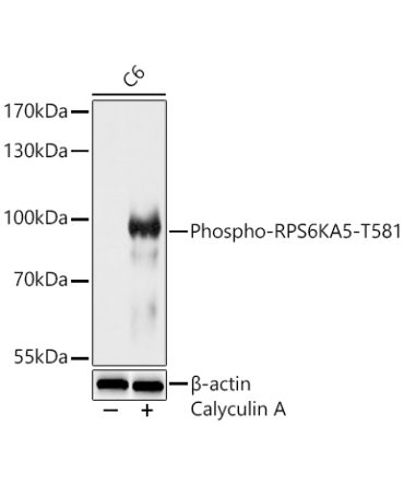 Phospho-RPS6KA5-T581 Rabbit Polyclonal Antibody
