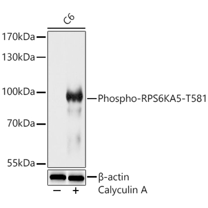 Phospho-RPS6KA5-T581 Rabbit Polyclonal Antibody
