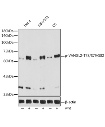 Phospho-VANGL2-T78/S79/S82 Rabbit Monoclonal Antibody