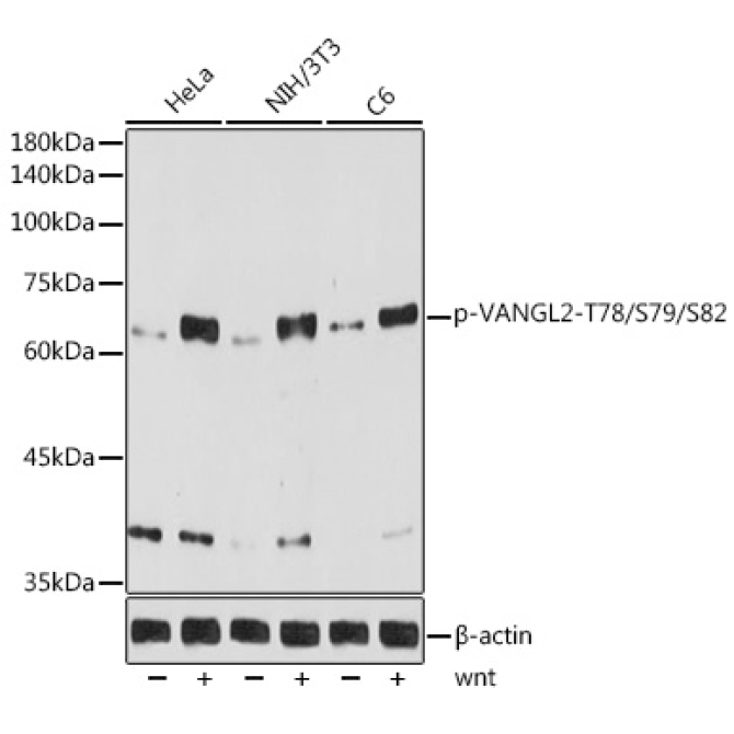Phospho-VANGL2-T78/S79/S82 Rabbit Monoclonal Antibody
