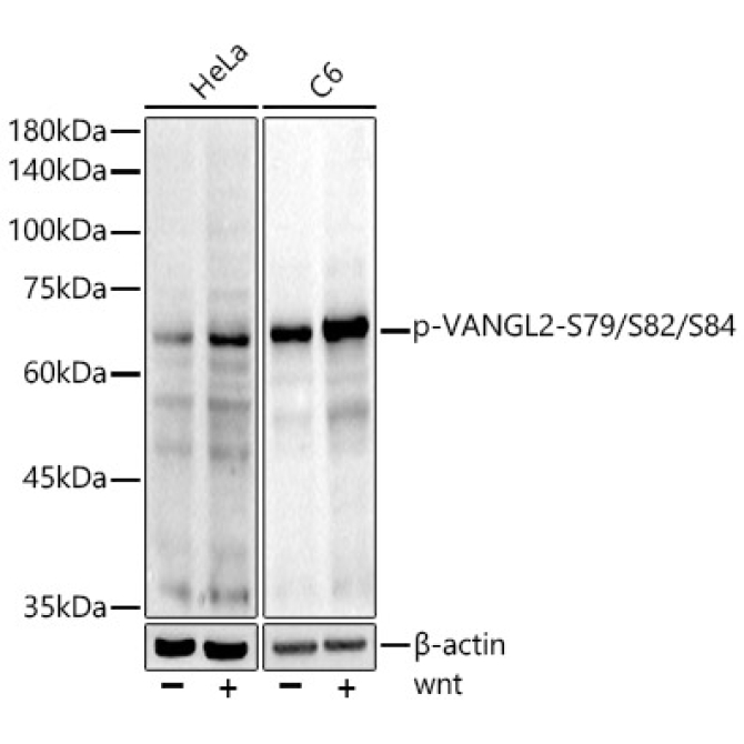 Phospho-VANGL2-S79/S82/S84 Rabbit Monoclonal Antibody