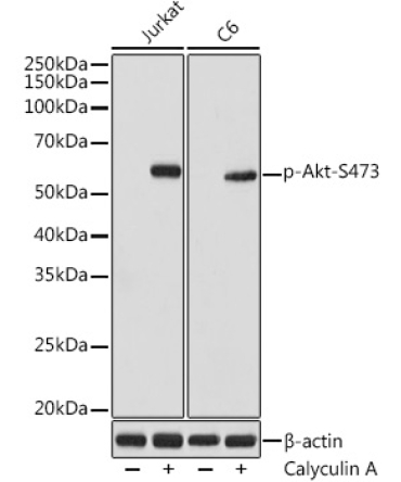 Phospho-Akt-S473 Rabbit Monoclonal Antibody