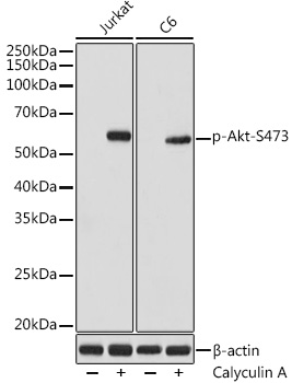 Phospho-Akt-S473 Rabbit Monoclonal Antibody