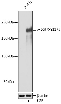 Phospho-EGFR-Y1173 Rabbit Polyclonal Antibody