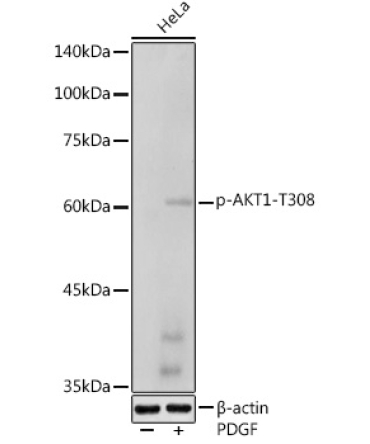 Phospho-AKT1-T308 Rabbit Polyclonal Antibody