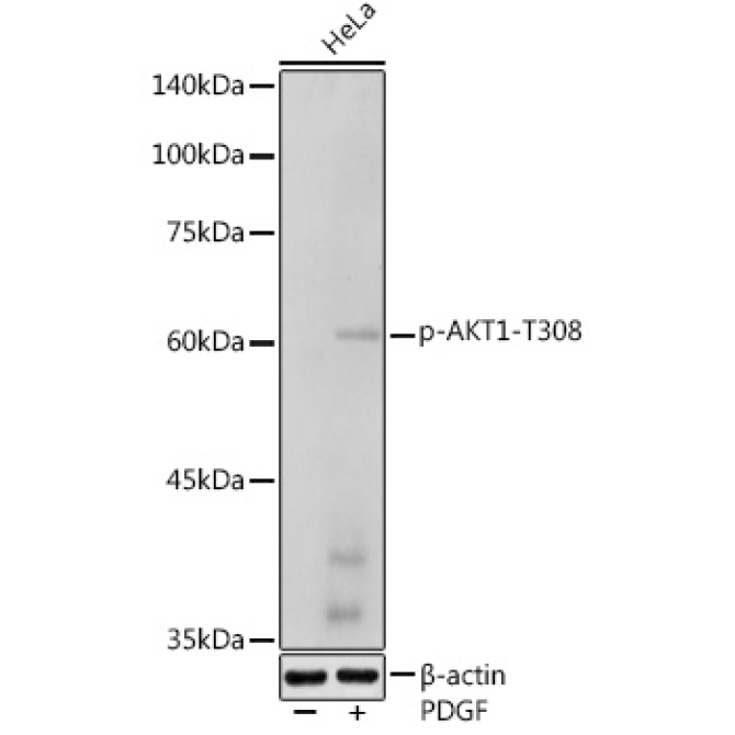 Phospho-AKT1-T308 Rabbit Polyclonal Antibody