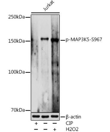 Phospho-MAP3K5-S967 Rabbit Polyclonal Antibody