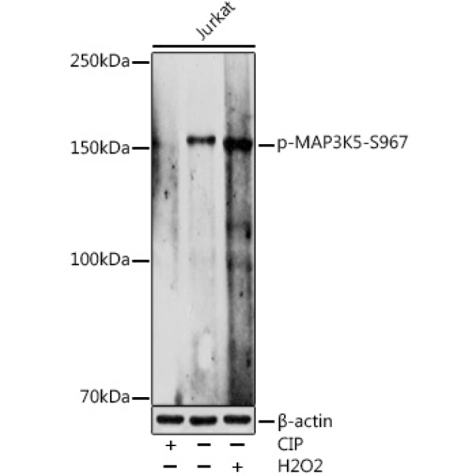 Phospho-MAP3K5-S967 Rabbit Polyclonal Antibody