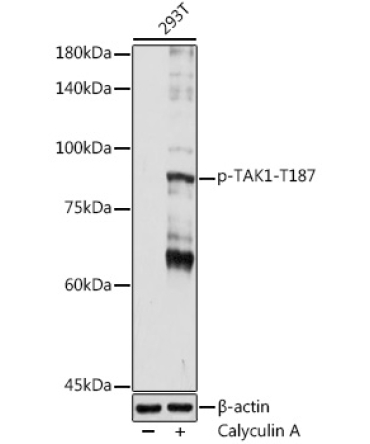 Phospho-TAK1-T187 Rabbit Polyclonal Antibody