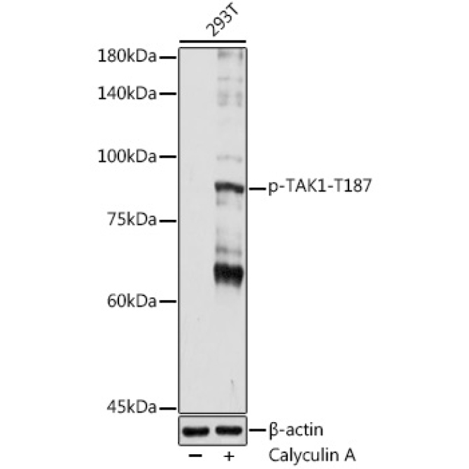 Phospho-TAK1-T187 Rabbit Polyclonal Antibody