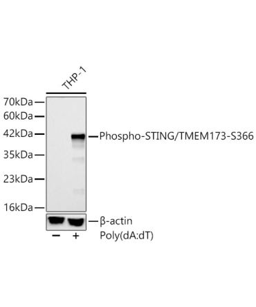 Phospho-STING/TMEM173-S366 Rabbit Polyclonal Antibody