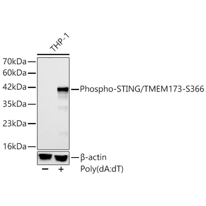 Phospho-STING/TMEM173-S366 Rabbit Polyclonal Antibody