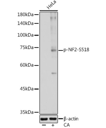 Phospho-NF2-S518 Rabbit Polyclonal Antibody