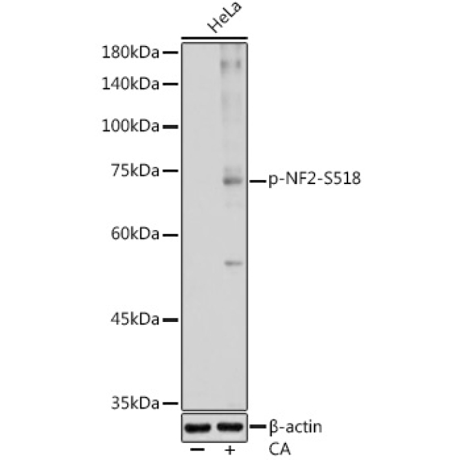 Phospho-NF2-S518 Rabbit Polyclonal Antibody