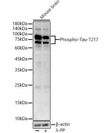 Phospho-Tau-T217 Rabbit Polyclonal Antibody